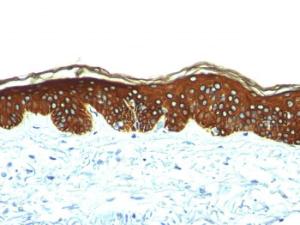 Immunohistochemical analysis of formalin-fixed, paraffin-embedded human skin using Anti-Keratin 76 Antibody [AE-3]