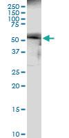 Anti-BMPR1B Rabbit Polyclonal Antibody