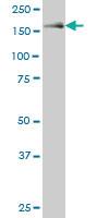 Anti-MAP3K5 Mouse Monoclonal Antibody [clone: X1]