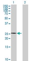 Anti-TSPAN17 Mouse Polyclonal Antibody