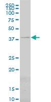 Anti-PSMC6 Mouse Monoclonal Antibody [clone: 2C4]