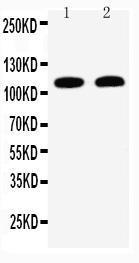 Anti-Desmoglein 3 Rabbit Polyclonal Antibody