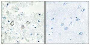 Antibody anti-DOK7 100 µg