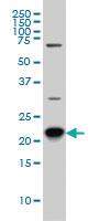 Anti-RAB8A Mouse Monoclonal Antibody [clone: 3G1]