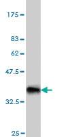 Anti-NODAL Mouse Monoclonal Antibody [clone: 5A3]