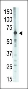 Anti-MMP14 Rabbit Polyclonal Antibody (HRP (Horseradish Peroxidase))