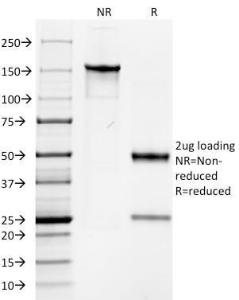 SDS-PAGE analysis of Anti-Keratin 76 Antibody [AE-3] under non-reduced and reduced conditions; showing intact IgG and intact heavy and light chains, respectively. SDS-PAGE analysis confirms the integrity and purity of the antibody