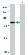 Anti-EHHADH Rabbit Polyclonal Antibody