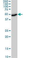 Anti-AKT3 Mouse Monoclonal Antibody [clone: 6F12]