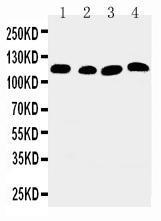 Anti-SERCA2 ATPase Rabbit Polyclonal Antibody