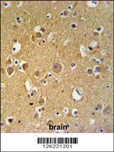 Anti-TUBB4B Rabbit Polyclonal Antibody (HRP (Horseradish Peroxidase))