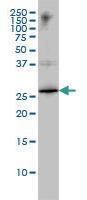 Anti-HMGB1 Mouse Monoclonal Antibody [clone: 1D5]