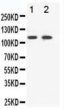 Anti-Eph Receptor B3 Rabbit Polyclonal Antibody