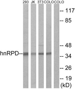 Western blot analysis of lysates from 293, Jurkat, 3T3, and COLO205 cells using Anti-hnRPD Antibody. The right hand lane represents a negative control, where the antibody is blocked by the immunising peptide.