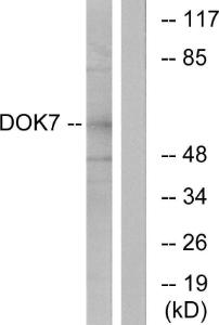 Antibody anti-DOK7 100 µg