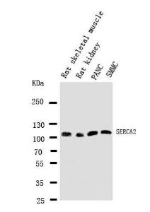 Anti-SERCA2 ATPase Rabbit Polyclonal Antibody