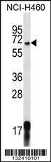 Anti-GPSM1 Rabbit Polyclonal Antibody (AP (Alkaline Phosphatase))