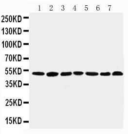 Anti-CtBP1 Rabbit Polyclonal Antibody