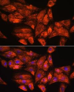 Immunofluorescence analysis of H9C2 cells using Anti-GADD34 Antibody (A92795) at a dilution of 1:100. DAPI was used to stain the cell nuclei (blue)