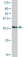 Anti-ATOX1 Mouse Monoclonal Antibody [clone: 4D6]