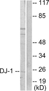 Western blot analysis of lysates from HUVEC cells using Anti-DJ-1 Antibody. The right hand lane represents a negative control, where the Antibody is blocked by the immunising peptide