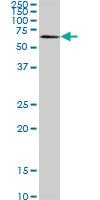 Anti-AKT3 Mouse Monoclonal Antibody [clone: 6F12]