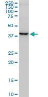 Anti-FBXO22 Mouse Monoclonal Antibody [clone: 6G9]