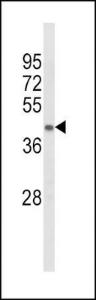 Anti-ACADL Rabbit Polyclonal Antibody (Biotin)