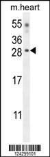 Anti-CLDN6 Rabbit Polyclonal Antibody