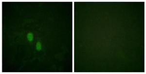 Immunofluorescence analysis of HeLa cells using Anti-hnRPD Antibody. The right hand panel represents a negative control, where the antibody was pre-incubated with the immunising peptide.