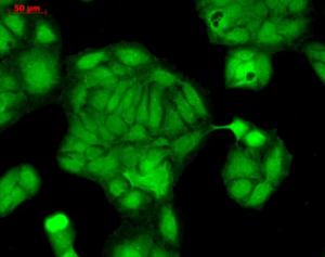 Immunocytochemistry/Immunofluorescence analysis of human HaCaT cells, fixed in cold 100% methanol at -20°C for 10 minutes, using Anti-Rab4 Antibody (A304983), at 1:100 for 12 hours at 4°