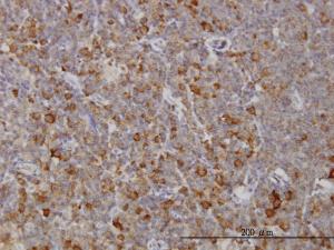 Anti-RAB8A Mouse Monoclonal Antibody [clone: 3G1]