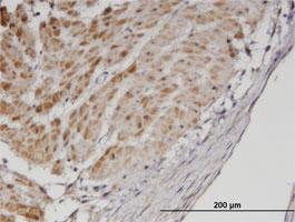 Anti-TPM3 Mouse Monoclonal Antibody [clone: 2E4]