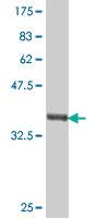 Anti-UGT1A6 Mouse Polyclonal Antibody