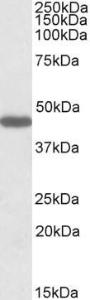 Anti-PROKR2 Antibody (A84724) (1µg/ml) staining of Rat Stomach lysate (35µg protein in RIPA buffer). Primary incubation was 1 hour. Detected by chemiluminescence.