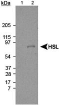 Anti-LIPE Rabbit Polyclonal Antibody