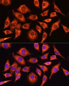 Immunofluorescence analysis of L929 cells using Anti-GADD34 Antibody (A92795) at a dilution of 1:100. DAPI was used to stain the cell nuclei (blue)