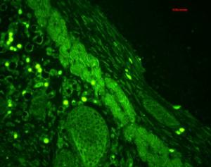 Immunohistochemistry analysis of mouse backskin, fixed in Bouin's fixative solutio