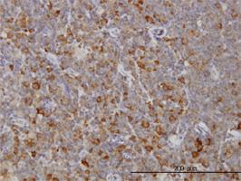 Anti-RAB8A Mouse Monoclonal Antibody [clone: 3G1]