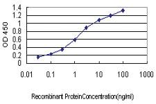 Anti-AKT3 Mouse Monoclonal Antibody [clone: 6F12]