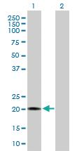 Anti-RBBP9 Mouse Polyclonal Antibody