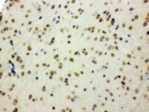 Anti-SHC1 Rabbit Polyclonal Antibody