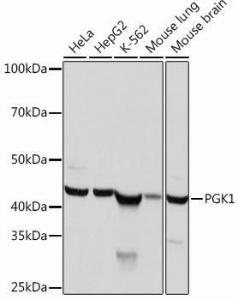 Western blot analysis of extracts of various cell lines, using Anti-PGK1 Antibody [ARC0700] (A307800) at 1:1,000 dilution