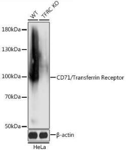 Western blot analysis of extracts from normal (control) and CD71/Transferrin Receptor knockout (KO) HeLa cells, using Anti-Transferrin Receptor Antibody (A92796) at 1:5,000 dilution