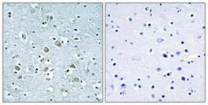 Anti-NEURL Rabbit Polyclonal Antibody