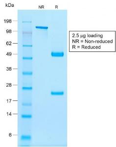 SDS-PAGE analysis of Anti-NKX2.2 Antibody [rNX2/294] under non-reduced and reduced conditions; showing intact IgG and intact heavy and light chains, respectively. SDS-PAGE analysis confirms the integrity and purity of the antibody