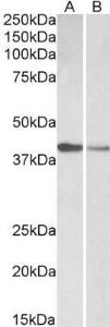 Anti-TNNT2 Antibody (A83132) (0.1µg/ml) staining of Human (A) and Mouse (B) Heart lysate (35µg protein in RIPA buffer). Primary incubation was 1 hour. Detected by chemiluminescence.