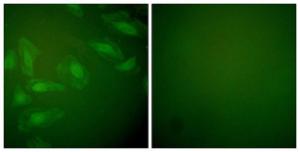 Immunofluorescence analysis of HeLa cells using Anti-DJ-1 Antibody. The right hand panel represents a negative control, where the Antibody was pre-incubated with the immunising peptide