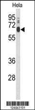 Anti-PCAT1 Rabbit Polyclonal Antibody