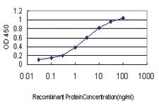 Anti-RAB8A Mouse Monoclonal Antibody [clone: 3G1]